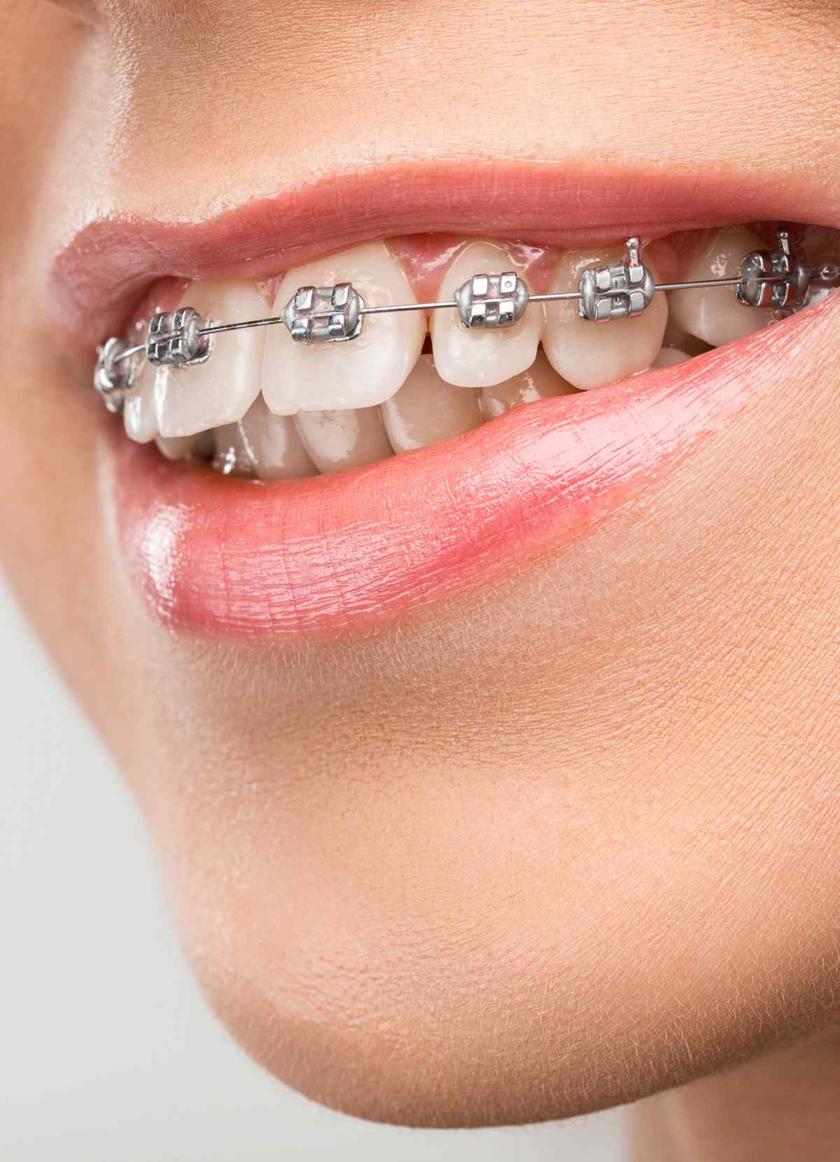 https://dentalestetik.al/wp-content/uploads/2023/05/inner_image_04.jpg